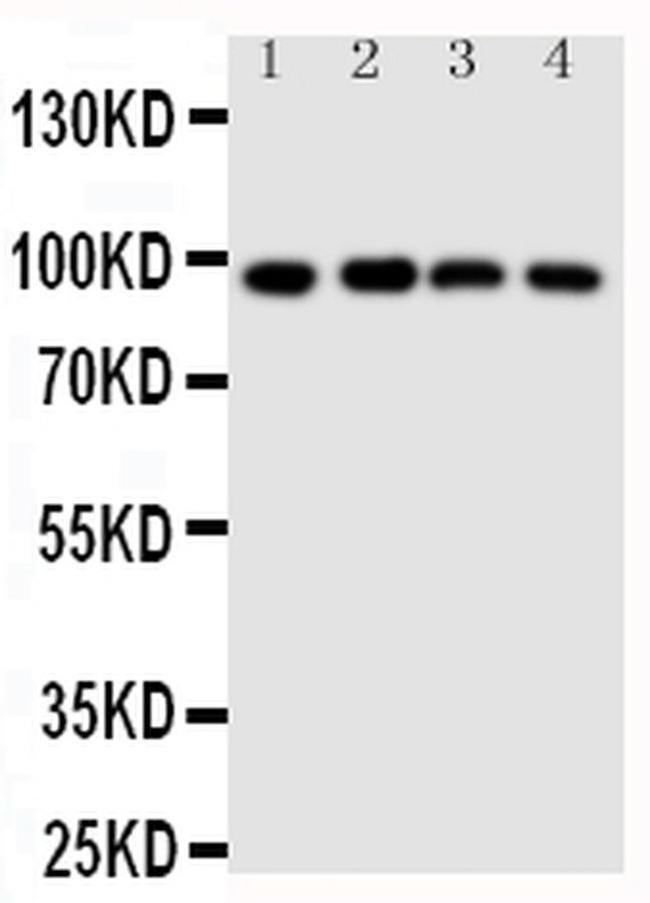 SIDT1 Antibody in Western Blot (WB)
