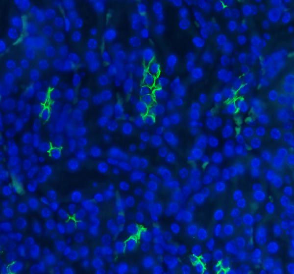 SLC12A1 Antibody in Immunohistochemistry (Paraffin) (IHC (P))