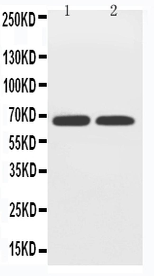 SLC2A12 Antibody in Western Blot (WB)