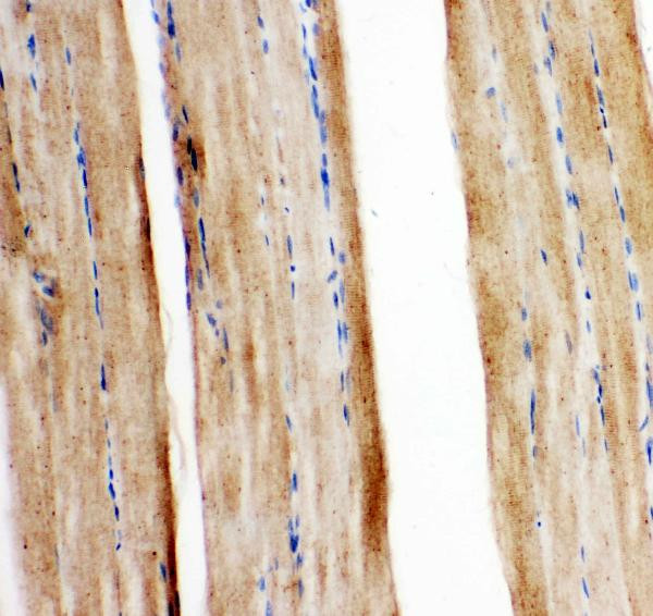 GLUT5 Antibody in Immunohistochemistry (Paraffin) (IHC (P))