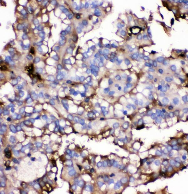 GLUT9 Antibody in Immunohistochemistry (Paraffin) (IHC (P))