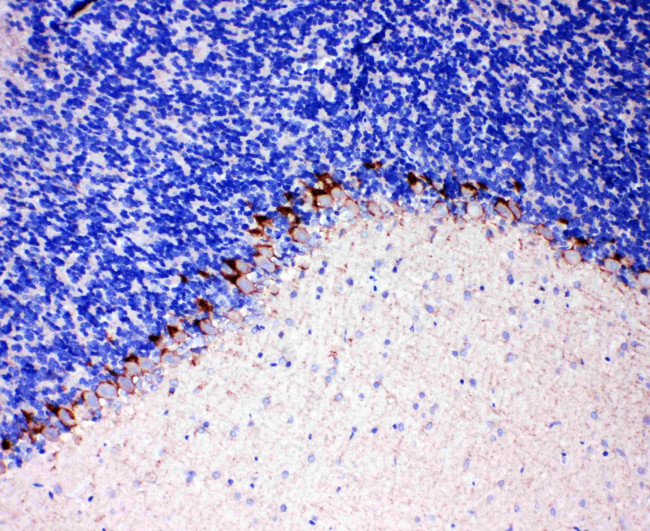 GAT-1 Antibody in Immunohistochemistry (Paraffin) (IHC (P))