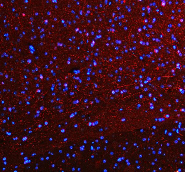 SLC6A4 Antibody in Immunohistochemistry (Paraffin) (IHC (P))