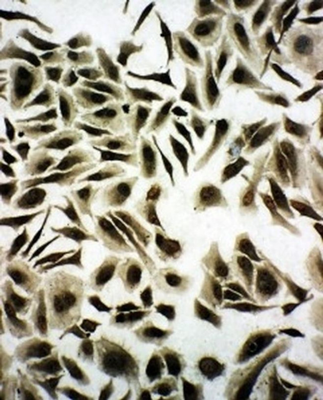 SNRPN Antibody in Immunocytochemistry (ICC/IF)