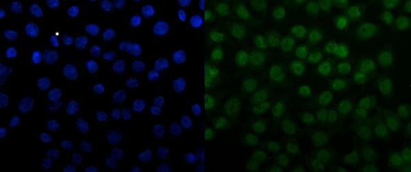 SNRPN Antibody in Immunocytochemistry (ICC/IF)