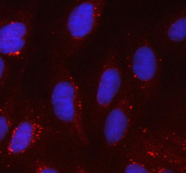 SOD2 (MnSOD) Antibody in Immunocytochemistry (ICC/IF)