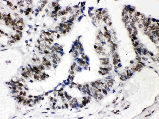 SP3 Antibody in Immunohistochemistry (Paraffin) (IHC (P))