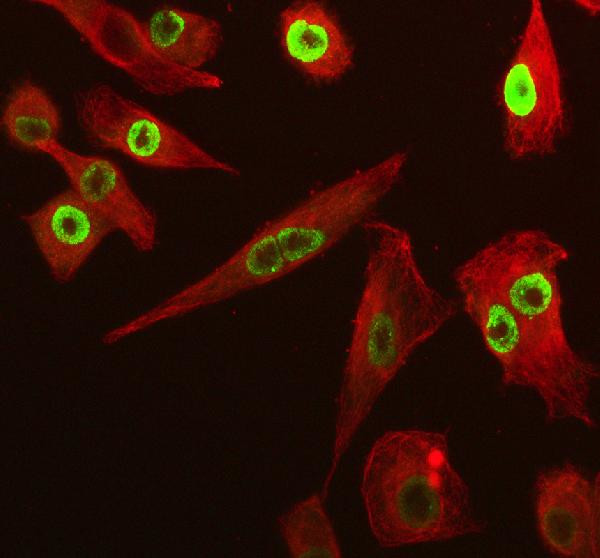SP6 Antibody in Immunocytochemistry (ICC/IF)