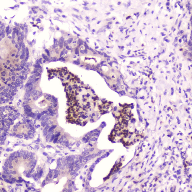 SPARCL1 Antibody in Immunohistochemistry (Paraffin) (IHC (P))