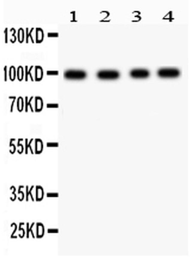 Synaptopodin Antibody in Western Blot (WB)