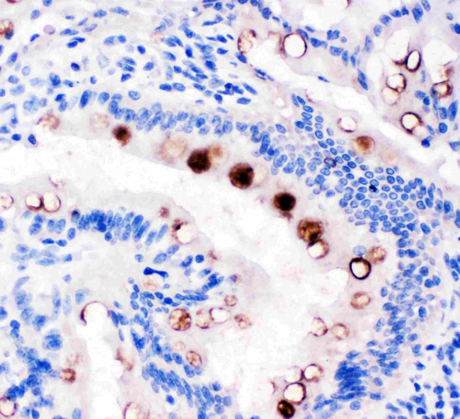 TFF1 Antibody in Immunohistochemistry (Paraffin) (IHC (P))