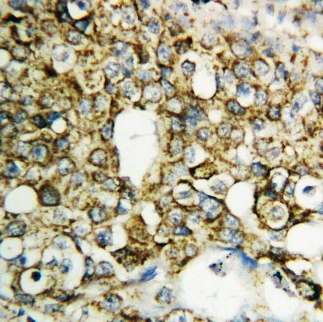TFPI2 Antibody in Immunohistochemistry (Paraffin) (IHC (P))