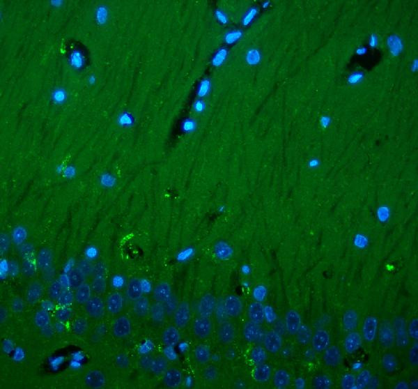 CD90 Antibody in Immunohistochemistry (Paraffin) (IHC (P))