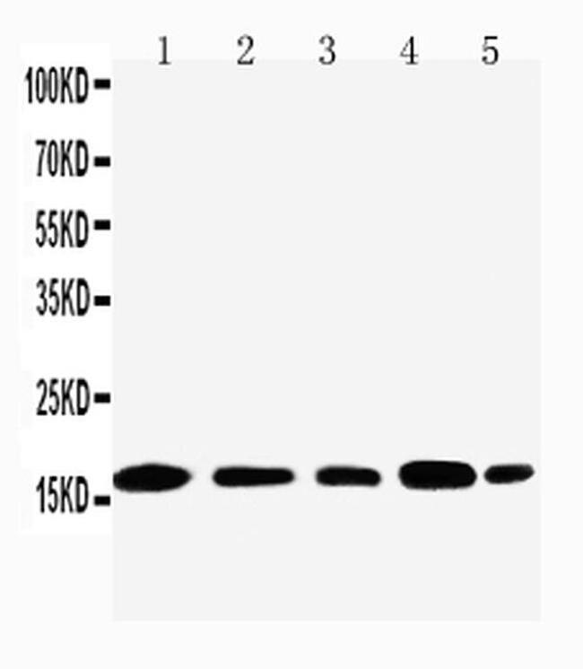 TIA-1 isoform p40 Antibody in Western Blot (WB)