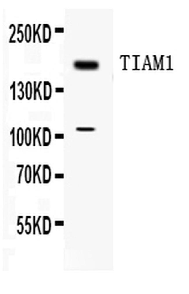 TIAM1 Antibody in Western Blot (WB)