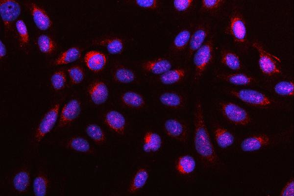 DR4 Antibody in Immunocytochemistry (ICC/IF)