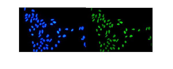 TOP1 Antibody in Immunocytochemistry (ICC/IF)