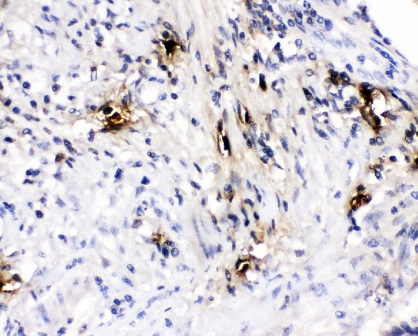Tryptase Antibody in Immunohistochemistry (Paraffin) (IHC (P))