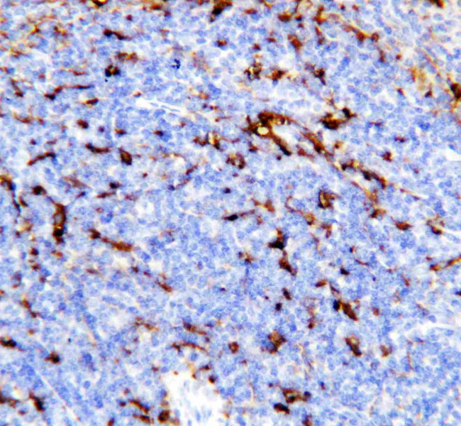 TREM1 Antibody in Immunohistochemistry (Paraffin) (IHC (P))