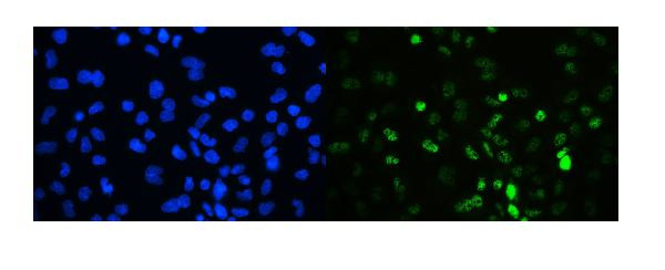 TIF1 gamma Antibody in Immunocytochemistry (ICC/IF)