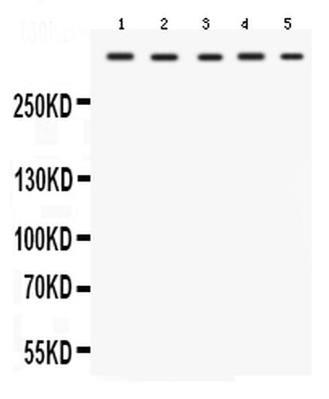 TRIO Antibody in Western Blot (WB)