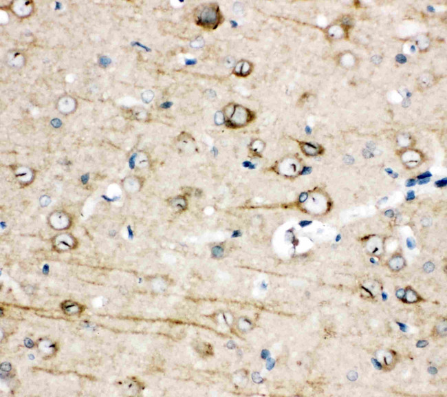 TRPC3 Antibody in Immunohistochemistry (Paraffin) (IHC (P))