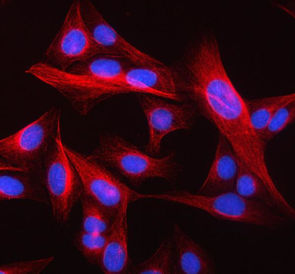 beta-5 Tubulin Antibody in Immunocytochemistry (ICC/IF)