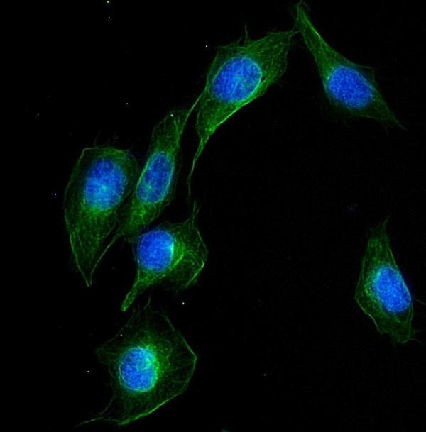 UBE2Q2 Antibody in Immunocytochemistry (ICC/IF)