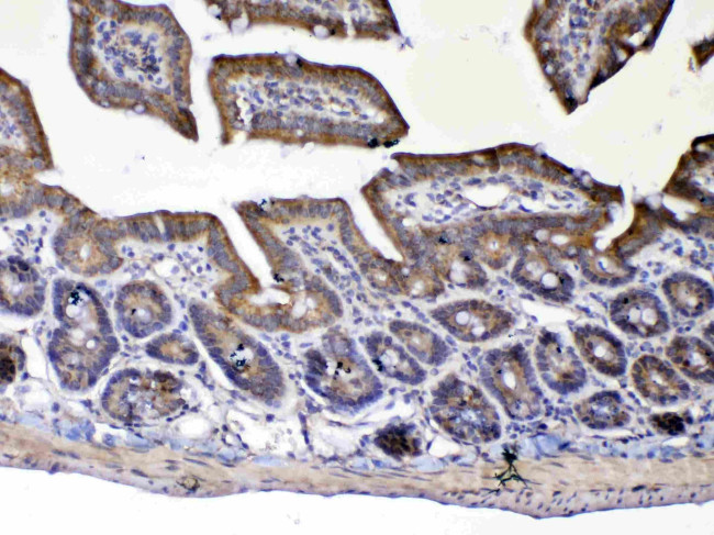 UGT1A1 Antibody in Immunohistochemistry (Paraffin) (IHC (P))