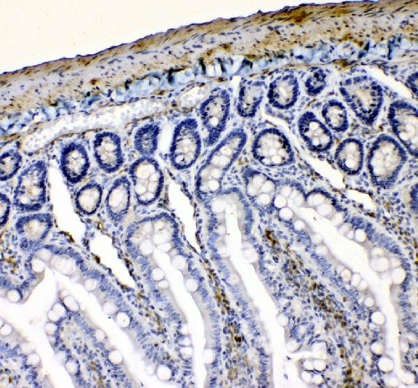 VASP Antibody in Immunohistochemistry (Paraffin) (IHC (P))