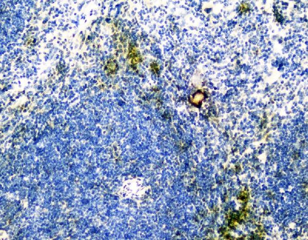 VCAM-1 (CD106) Antibody in Immunohistochemistry (Paraffin) (IHC (P))