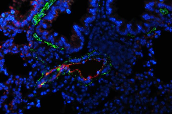 VWF Antibody in Immunohistochemistry (Paraffin) (IHC (P))