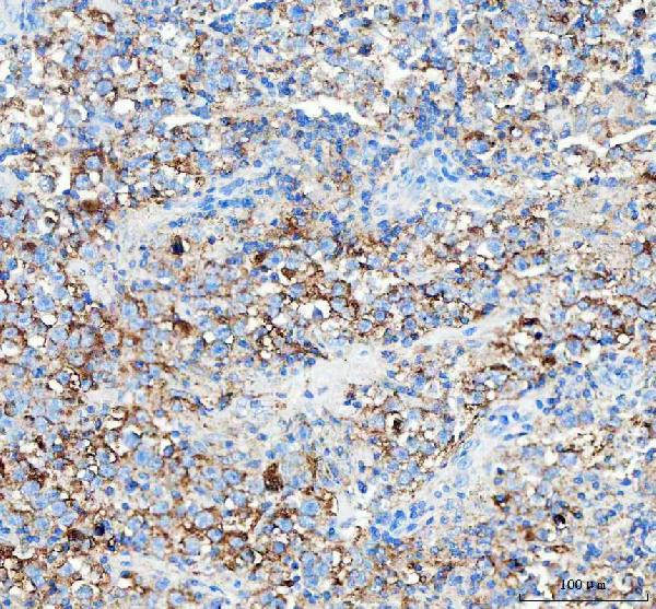 WISP1 Antibody in Immunohistochemistry (Paraffin) (IHC (P))