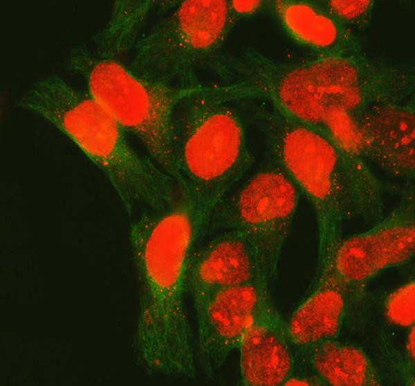 XRCC1 Antibody in Immunocytochemistry (ICC/IF)
