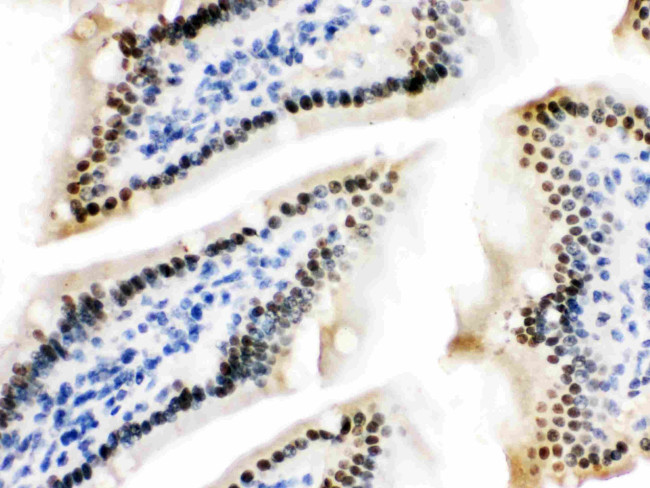 Pokemon Antibody in Immunohistochemistry (Paraffin) (IHC (P))