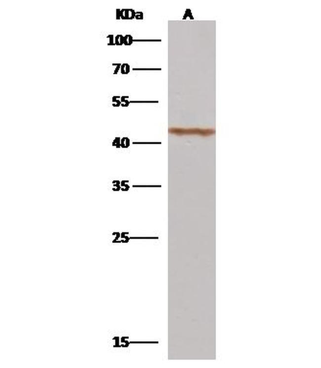 Micromonospora viridifaciens NA Antibody in Western Blot (WB)