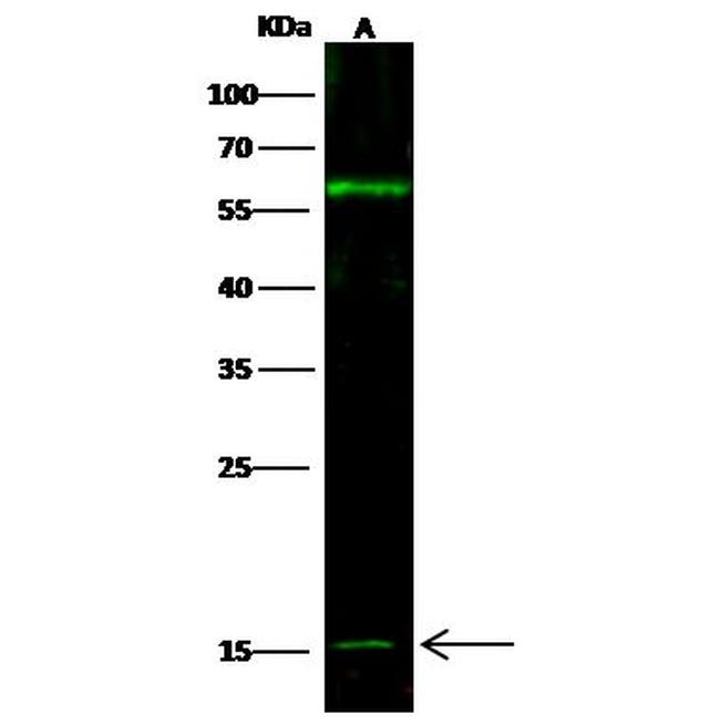 IFNA13 Antibody in Western Blot (WB)