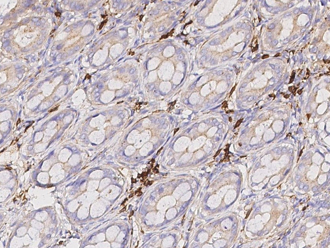 CD20 Antibody in Immunohistochemistry (Paraffin) (IHC (P))