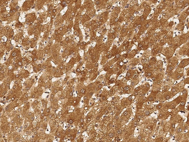 ACSS3 Antibody in Immunohistochemistry (Paraffin) (IHC (P))