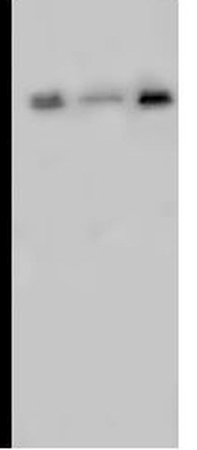 ACVR2A Antibody in Western Blot (WB)