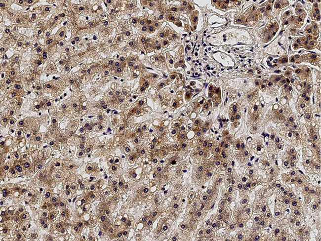 ACVRL1 Antibody in Immunohistochemistry (Paraffin) (IHC (P))
