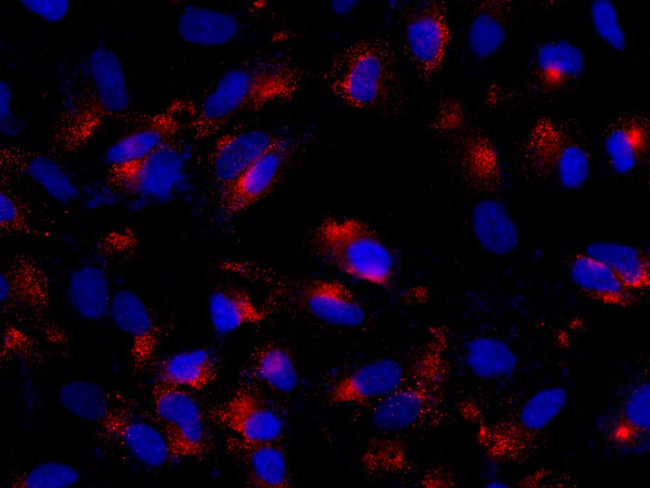 Adenosine Deaminase Antibody in Immunocytochemistry (ICC/IF)