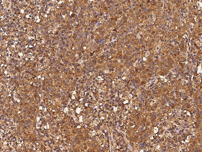 alpha Adducin Antibody in Immunohistochemistry (Paraffin) (IHC (P))