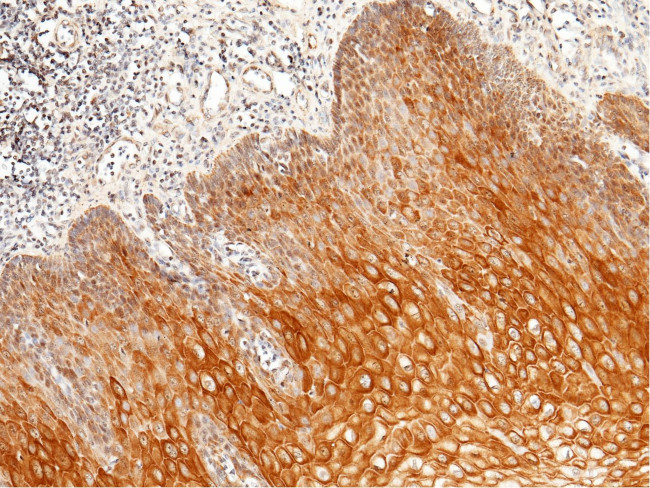 Intestinal Alkaline Phosphatase Antibody in Immunohistochemistry (Paraffin) (IHC (P))