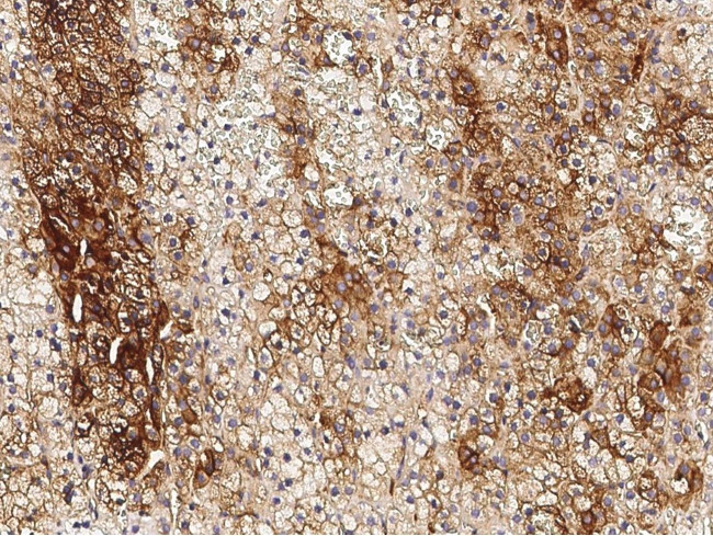 ALPL Antibody in Immunohistochemistry (Paraffin) (IHC (P))