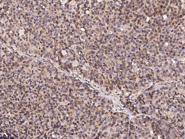 Alivin 1 Antibody in Immunohistochemistry (Paraffin) (IHC (P))