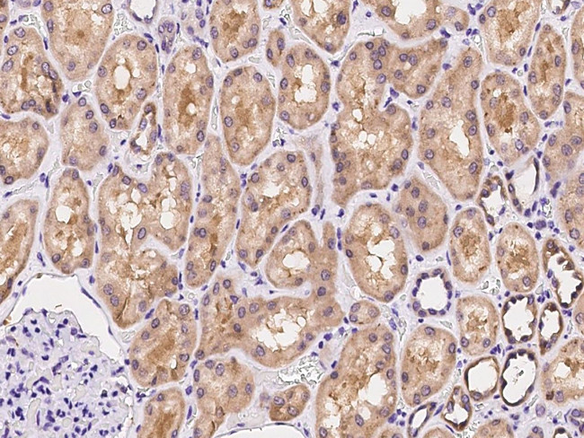 ARHGAP11A Antibody in Immunohistochemistry (Paraffin) (IHC (P))