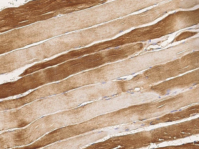 ARHGAP11B Antibody in Immunohistochemistry (Paraffin) (IHC (P))