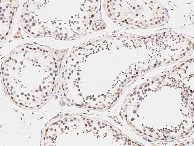 ARHGAP28 Antibody in Immunohistochemistry (Paraffin) (IHC (P))