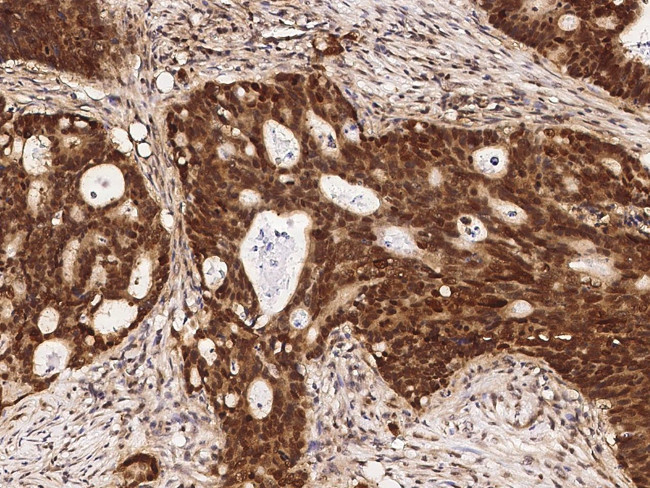 DRIL1 Antibody in Immunohistochemistry (Paraffin) (IHC (P))